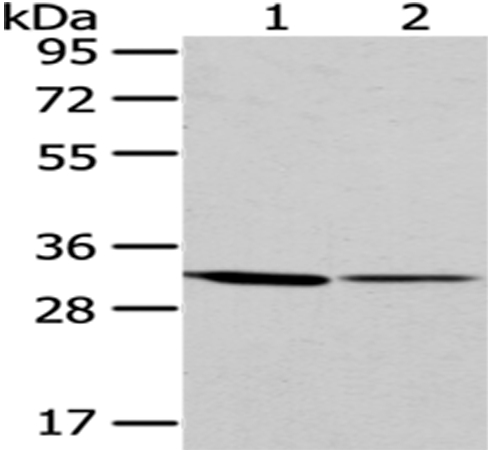 Rabbit Polyclonal Antibody to M6PR