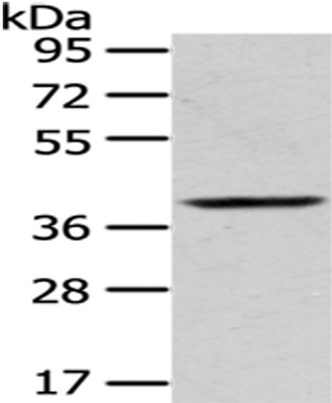 Rabbit Polyclonal Antibody to PLEK
