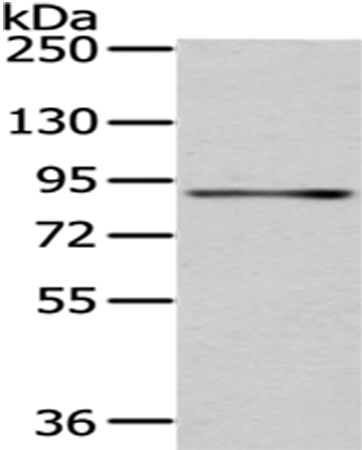 Rabbit Polyclonal Antibody to SSRP1