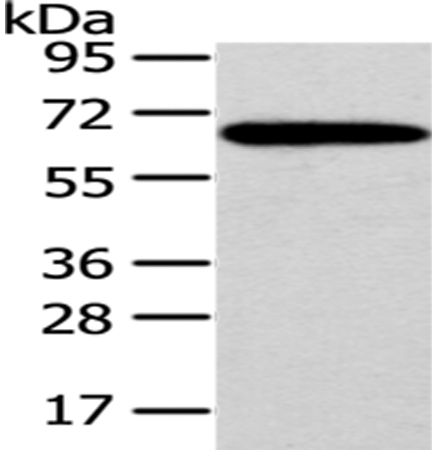 Rabbit Polyclonal Antibody to SF1