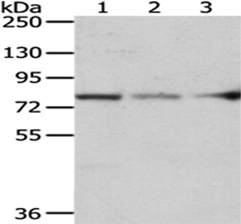 Rabbit Polyclonal Antibody to ACSS2