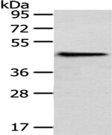 Rabbit Polyclonal Antibody to HPD