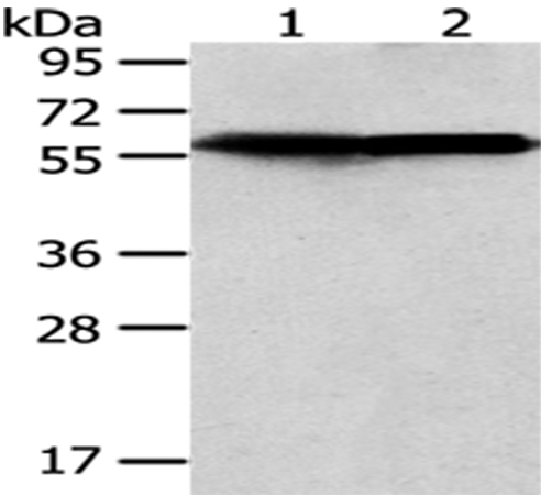 Rabbit Polyclonal Antibody to CCT5