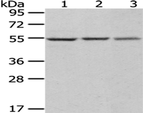 Rabbit Polyclonal Antibody to DARS