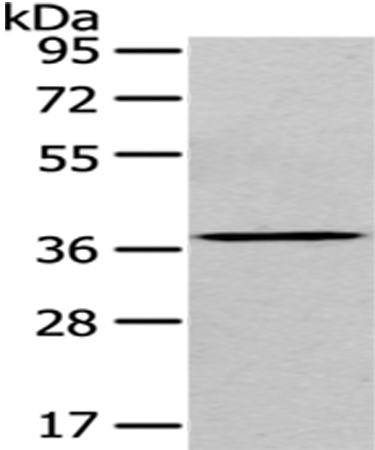 Rabbit Polyclonal Antibody to EIF3I