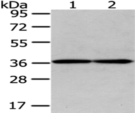 Rabbit Polyclonal Antibody to GALE
