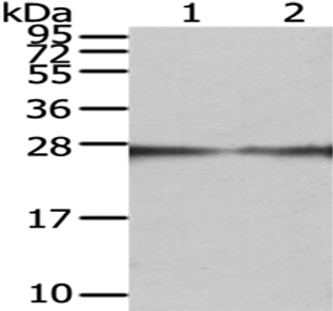 Rabbit Polyclonal Antibody to GAMT