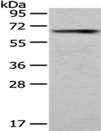Rabbit Polyclonal Antibody to PUF6