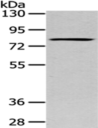 Rabbit Polyclonal Antibody to SETMAR