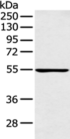 Rabbit Polyclonal Antibody to PFKFB4