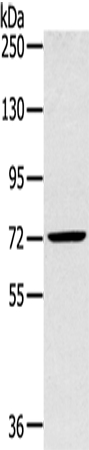 Rabbit Polyclonal Antibody to SLC27A5
