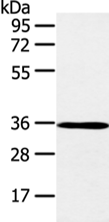 Rabbit Polyclonal Antibody to E2F5