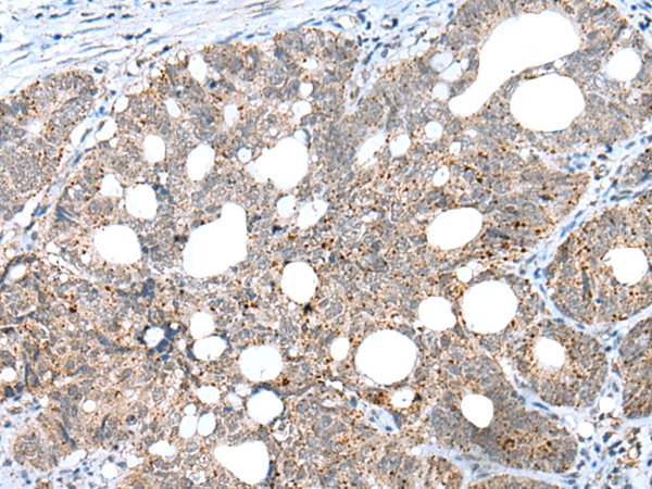 Rabbit Polyclonal Antibody to CLEC4M