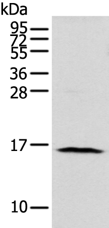 Rabbit Polyclonal Antibody to NUDT1