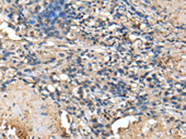 Rabbit Polyclonal Antibody to PRTFDC1
