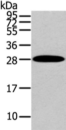 Rabbit Polyclonal Antibody to ZNF365