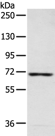 Rabbit Polyclonal Antibody to CAMKK2