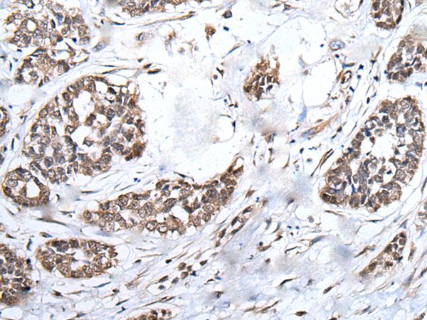 Rabbit Polyclonal Antibody to BRMS1L