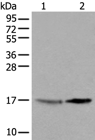 Rabbit Polyclonal Antibody to UBE2W