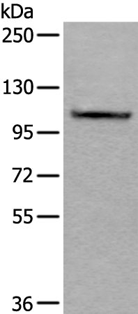 Rabbit Polyclonal Antibody to AMOTL1