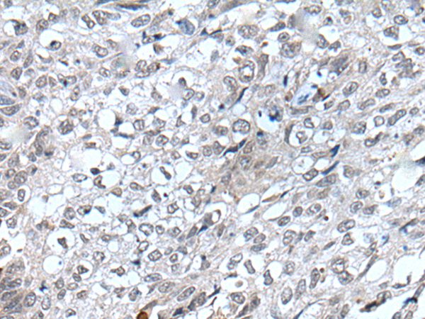 Rabbit Polyclonal Antibody to FLT4
