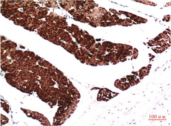 Mouse Monoclonal Antibody to Muscle actin Mouse(1E9)