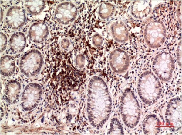 Mouse Monoclonal Antibody to Epsilon Tubulin Mouse(3G1)