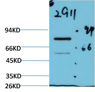 Mouse Monoclonal Antibody to Luciferase Mouse(2G11)