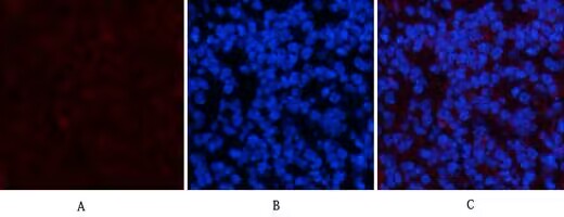 Mouse Monoclonal Antibody to PDGFRα Mouse(7A3)