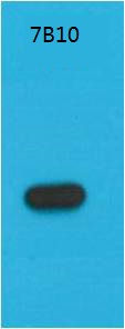 Mouse Monoclonal Antibody to S1-Tag(F321)