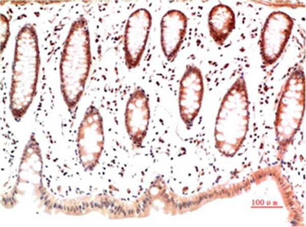 Mouse Monoclonal Antibody to Collagen I Mouse(4H10)