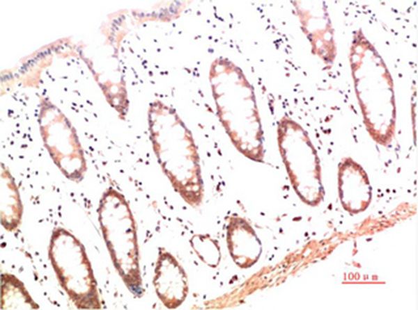 Mouse Monoclonal Antibody to Collagen I Mouse(4B5)