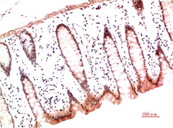 Mouse Monoclonal Antibody to Collagen I Mouse(2D10)