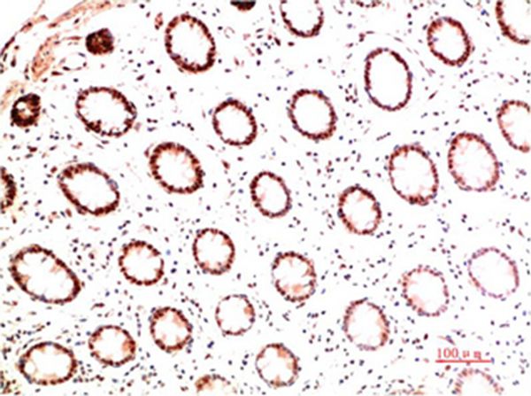 Mouse Monoclonal Antibody to Collagen I Mouse(5B7)