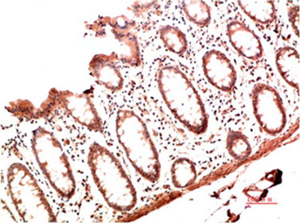 Mouse Monoclonal Antibody to Collagen I Mouse(1B2)