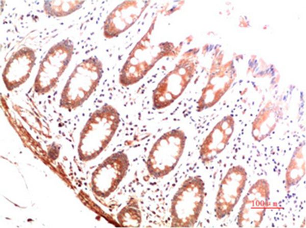 Mouse Monoclonal Antibody to Collagen I Mouse(6E11)