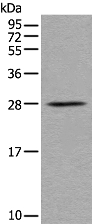 Rabbit Polyclonal Antibody to BARX1