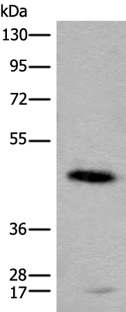 Rabbit Polyclonal Antibody to CADM2