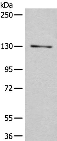 Rabbit Polyclonal Antibody to CASR