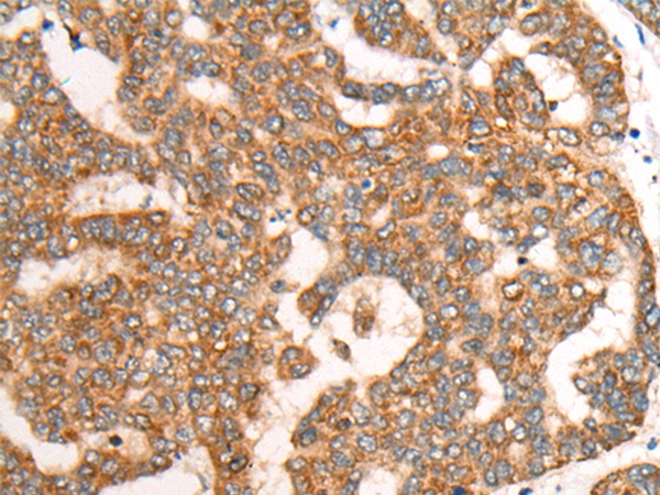 Rabbit Polyclonal Antibody to CDON