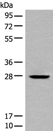 Rabbit Polyclonal Antibody to CHODL