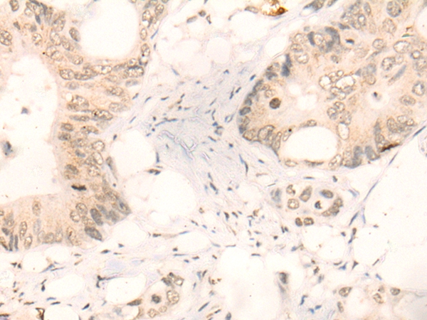 Rabbit Polyclonal Antibody to KLF2