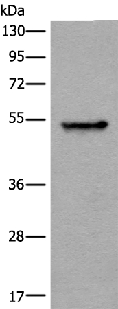 Rabbit Polyclonal Antibody to PFKFB4