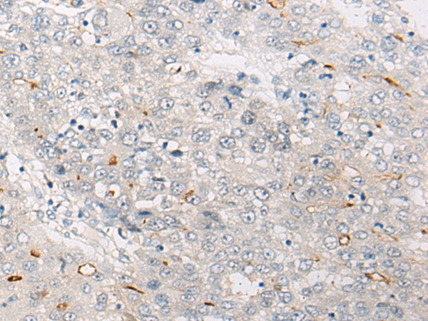 Rabbit Polyclonal Antibody to PNPO