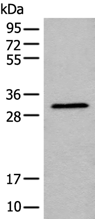 Rabbit Polyclonal Antibody to RCAN3