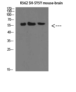 Rabbit Polyclonal Antibody to E-Selectin