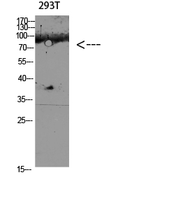 Rabbit Polyclonal Antibody to CD168