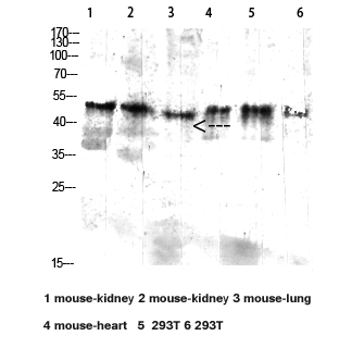 Rabbit Polyclonal Antibody to CD64