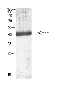 Rabbit Polyclonal Antibody to IL-12B p40
