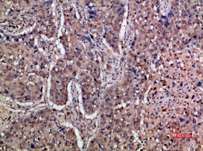 Rabbit Polyclonal Antibody to IFN-α/βRα